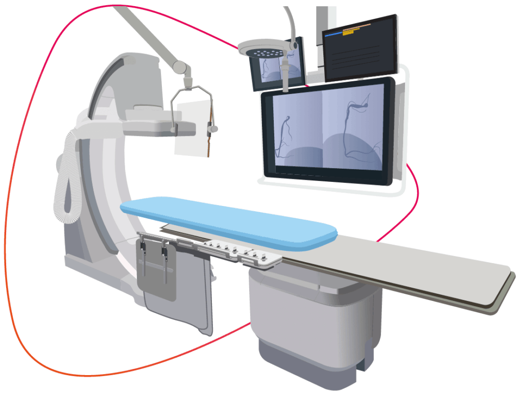 Cath lab image